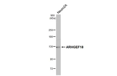 Anti-ARHGEF18 antibody used in Western Blot (WB). GTX102223