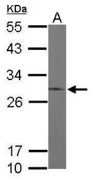 Anti-ERP29 antibody used in Western Blot (WB). GTX102225