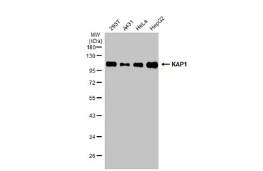 Anti-KAP1 antibody [N3C2], Internal used in Western Blot (WB). GTX102226