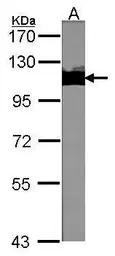 Anti-KAP1 antibody [N3C2], Internal used in Western Blot (WB). GTX102226