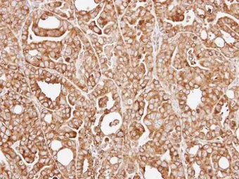 Anti-RPL13A antibody [N1C3] used in IHC (Paraffin sections) (IHC-P). GTX102228