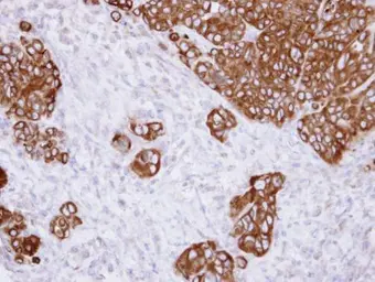 Anti-alpha Glucosidase II antibody [N1N2], N-term used in IHC (Paraffin sections) (IHC-P). GTX102237