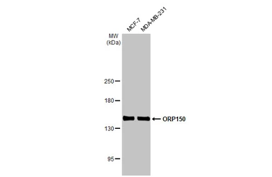 Anti-ORP150 antibody [C2C3], C-term used in Western Blot (WB). GTX102255