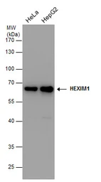 Anti-HEXIM1 antibody [N1C1] used in Western Blot (WB). GTX102283
