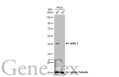 Anti-AHA-1 antibody [N2C3] used in Western Blot (WB). GTX102321
