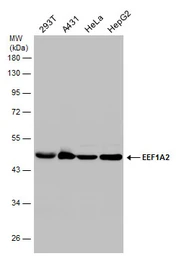Anti-EEF1A2 antibody used in Western Blot (WB). GTX102326