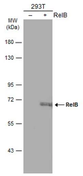 Anti-RelB antibody used in Western Blot (WB). GTX102332