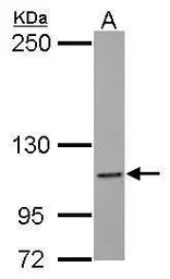Anti-CARD12 antibody [N1], N-term used in Western Blot (WB). GTX102366