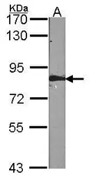 Anti-FAF1 antibody used in Western Blot (WB). GTX102369