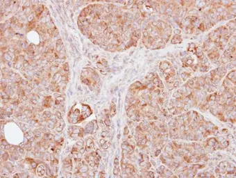 Anti-TRAF1 antibody [N1C1] used in IHC (Paraffin sections) (IHC-P). GTX102372