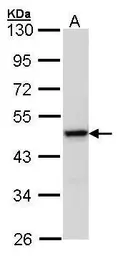 Anti-MEK1 antibody used in Western Blot (WB). GTX102391