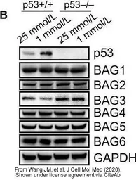 Anti-BAG3 antibody used in Western Blot (WB). GTX102396