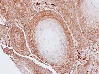 Anti-BAG3 antibody used in IHC (Paraffin sections) (IHC-P). GTX102396