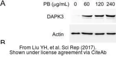 Anti-DAP Kinase 3 antibody used in Western Blot (WB). GTX102404