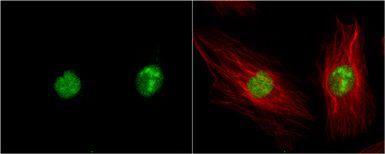 Anti-DAP Kinase 3 antibody used in Immunocytochemistry/ Immunofluorescence (ICC/IF). GTX102404