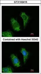 Anti-TRAF5 antibody [N1N3] used in Immunocytochemistry/ Immunofluorescence (ICC/IF). GTX102415