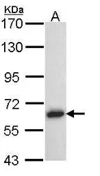 Anti-TRAF5 antibody [N1N3] used in Western Blot (WB). GTX102415