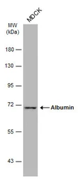 Anti-Albumin antibody used in Western Blot (WB). GTX102419