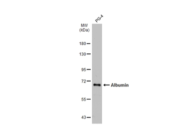 Anti-Albumin antibody used in Western Blot (WB). GTX102419