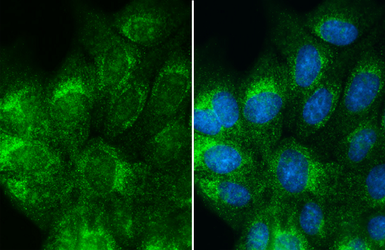 Anti-Albumin antibody used in Immunocytochemistry/ Immunofluorescence (ICC/IF). GTX102419