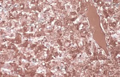 Anti-Albumin antibody used in IHC (Paraffin sections) (IHC-P). GTX102419