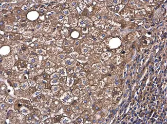 Anti-Albumin antibody used in IHC (Paraffin sections) (IHC-P). GTX102419