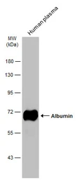 Anti-Albumin antibody used in Western Blot (WB). GTX102419