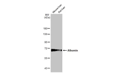 Anti-Albumin antibody used in Western Blot (WB). GTX102419