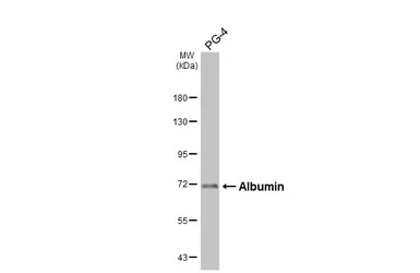 Anti-Albumin antibody used in Western Blot (WB). GTX102419