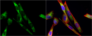 Anti-Tyrosine Hydroxylase antibody [N1C1] used in Immunocytochemistry/ Immunofluorescence (ICC/IF). GTX102424
