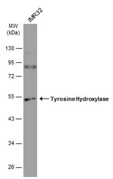 Anti-Tyrosine Hydroxylase antibody [N1C1] used in Western Blot (WB). GTX102424