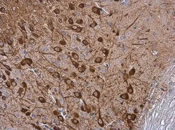 Anti-Tyrosine Hydroxylase antibody [N1C1] used in IHC (Paraffin sections) (IHC-P). GTX102424