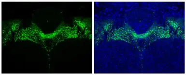 Anti-Tyrosine Hydroxylase antibody [N1C1] used in IHC (Paraffin sections) (IHC-P). GTX102424