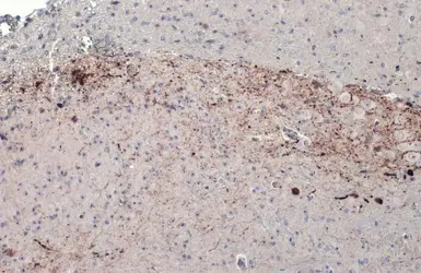 Anti-Tyrosine Hydroxylase antibody [N1C1] used in IHC (Paraffin sections) (IHC-P). GTX102424