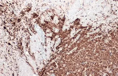 Anti-Tyrosine Hydroxylase antibody [N1C1] used in IHC (Paraffin sections) (IHC-P). GTX102424
