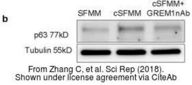 Anti-p63 antibody [N2C1], Internal used in Western Blot (WB). GTX102425