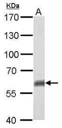 Anti-p63 antibody [N2C1], Internal used in Western Blot (WB). GTX102425