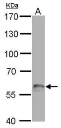 Anti-p63 antibody [N2C1], Internal used in Western Blot (WB). GTX102425