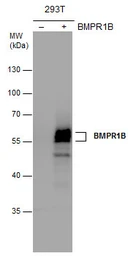 Anti-BMPR1B antibody [N3C3] used in Western Blot (WB). GTX102453
