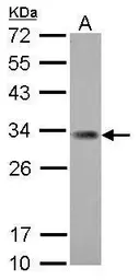 Anti-ING5 antibody [N2C1], Internal used in Western Blot (WB). GTX102482