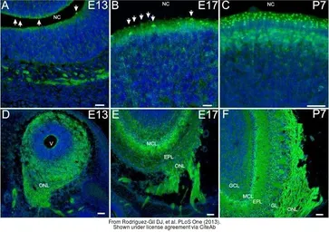 Anti-Dishevelled 3 antibody [N1N2], N-term used in IHC (Frozen sections) (IHC-Fr). GTX102509