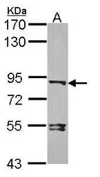 Anti-Dishevelled 3 antibody [N1N2], N-term used in Western Blot (WB). GTX102509
