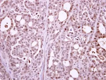 Anti-RPB2 antibody [N1], N-term used in IHC (Paraffin sections) (IHC-P). GTX102535