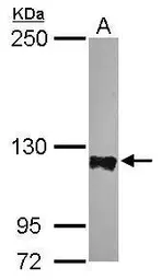 Anti-PTPN12 antibody [N1N2], N-term used in Western Blot (WB). GTX102542