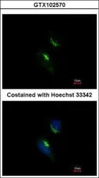 Anti-PRPS1 antibody used in Immunocytochemistry/ Immunofluorescence (ICC/IF). GTX102570
