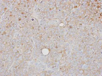 Anti-PRPS1 antibody used in IHC (Paraffin sections) (IHC-P). GTX102570