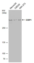 Anti-53BP1 antibody [N1], N-term used in Western Blot (WB). GTX102595