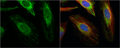 Anti-ACAT1 antibody [N1N3] used in Immunocytochemistry/ Immunofluorescence (ICC/IF). GTX102637