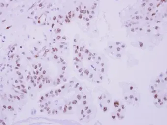 Anti-Topoisomerase II beta antibody [C3], C-term used in IHC (Paraffin sections) (IHC-P). GTX102640