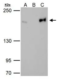 Anti-Topoisomerase II beta antibody [C3], C-term used in Immunoprecipitation (IP). GTX102640